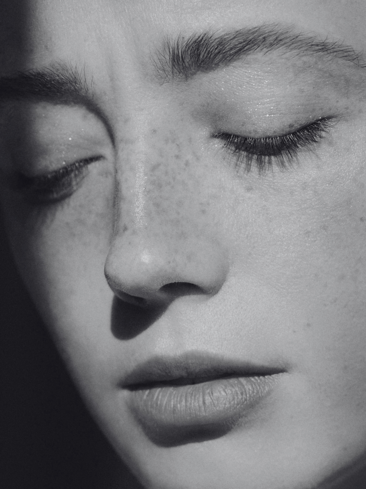 SKIN BOOSTERS